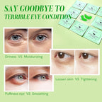 Under Eye Patches with Retinol and Aloe Vera Eye Mask for Dark Circles and Puffiness, Face Mask Skin Care Products 30 Pairs